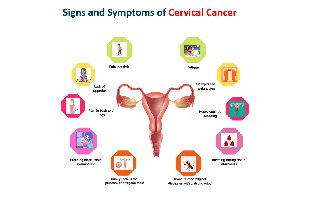 Signs and Symptoms of Cervical Cancer